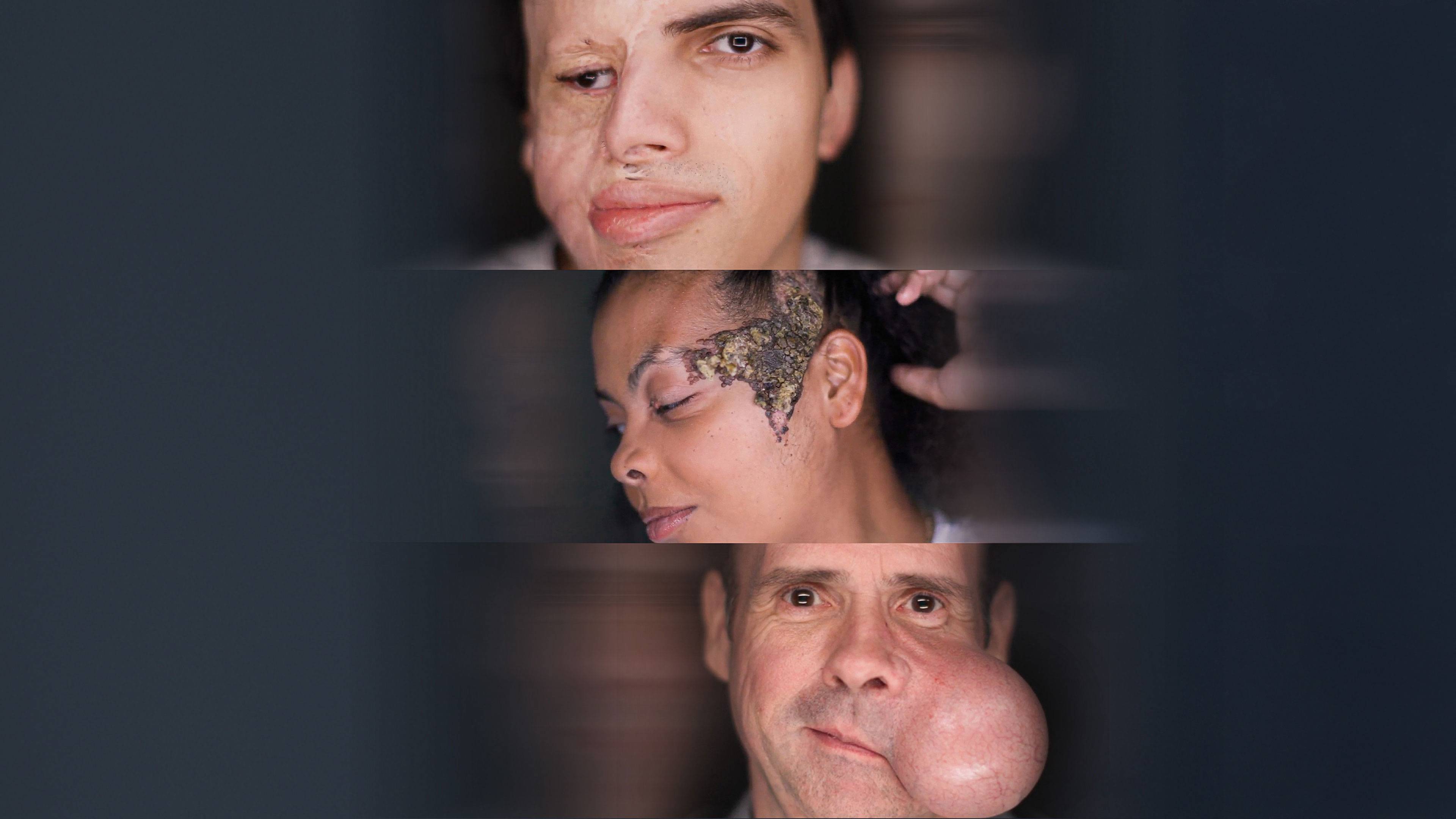 About Face Season 1 Episode 6 Tumors, Tumors, Everywhere
