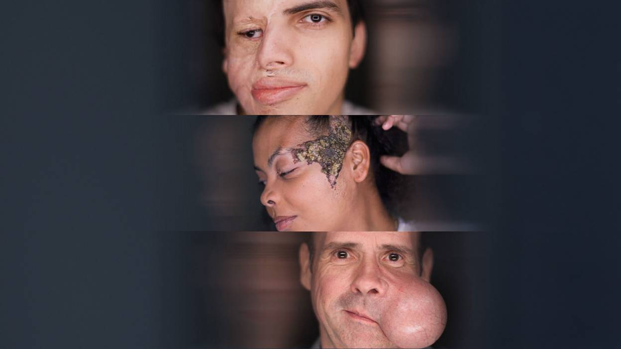 About Face